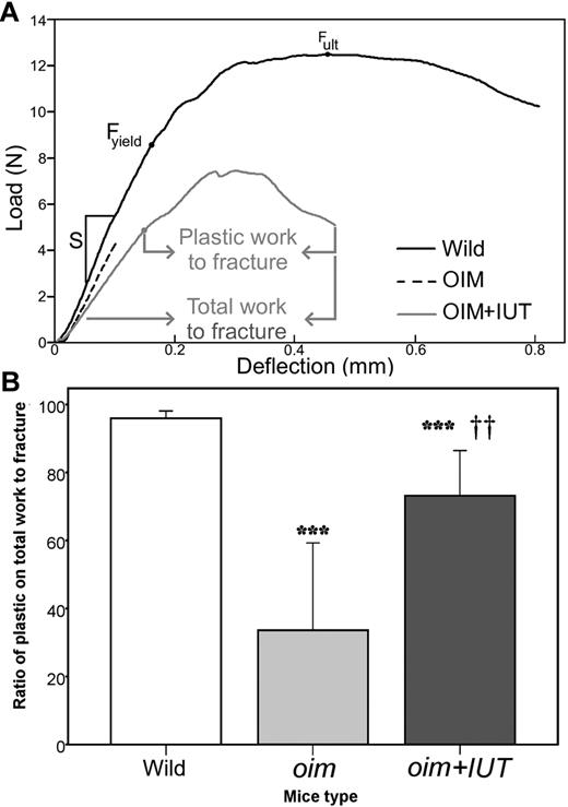 Figure 4. Three-point bending mechanical testing. (A) Representative examples of 3-point bending load-deflection curves until fracture obtained for WT, oim, and oim+IUT femurs: stiffness (S), ultimate force (Fult), yield force (Fyield), and total and plastic work to fracture are indicated. (B) Box-plot of the ratio of plastic/total work to fracture. ***P < .001 (significant difference vs WT group). ††P < .01 (significant difference vs oim group).