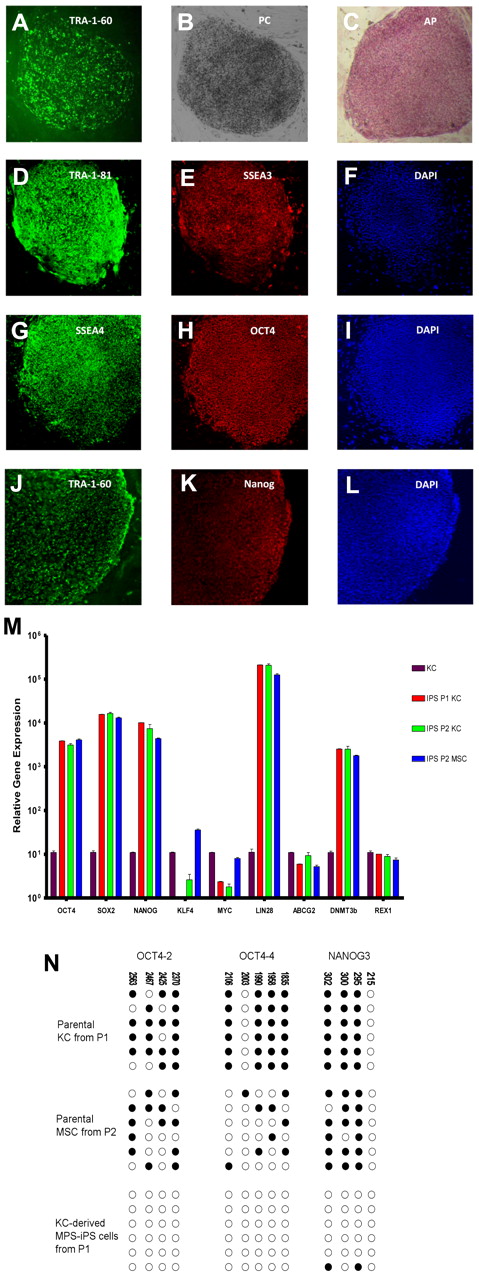 Figure 1. Induction of MPS IH somatic cells into MPS-iPS cells. (A) Live culture stained with TRA-1-60 antibody 4 weeks after transduction. (B) Phase contrast (PC) image of the same human ES cell-like colony. To confirm their ability to express ES cell proteins, human KCs derived from P1 were stained with alkaline phosphatase (C) and immunostained with TRA-1-81 (D), SSEA-3 (E), SSEA-4 (G), OCT4 (H), TRA-1-60 (J), and Nanog (K). Corresponding images stained with 4,6-diamidino-2-phenylindole (DAPI) show nuclei of individual cells in the colonies (F,I,L). Images in panels A-C were obtained with a Leica DMIL scope, magnification 10×/0.22. Images were acquired with an Optronics camera and Optronics MagnaFire software. Fluorescein isothiocyanate color block was used. Images in panels D-L were obtained with an Olympus BX61 FV500 Confocal Microscope, magnification 10×/.40. Argon, green HeNe, and blue diode lasers were used to acquire the images in Olympus FluoView software Version 4.3. All images were taken at room temperature. (M) Quantitative reverse transcription PCR analysis of OCT4, SOX2, NANOG, KLF4, c-MYC, LIN28, ABCG2, DNMT3b, and REX1 expression levels in KC-derived iPS cells from P1 (red bars), KC-derived iPS cells from P2 (green bars), and MSC-derived iPS cells from P2 (blue bars), respectively. All values were normalized against endogenous GAPDH expression. Because MPS-KCs and MPS-MSCs expressed statistically indistinguishable levels of these ES cell marker genes, their values were plotted against expression levels of parental MPS-KCs from P1 (black bars). (N) Bisulfite sequencing of the OCT4 and NANOG promoters in parental MPS-KCs (from P1), parental MPS-MSCs (from P2), and MPS-iPS cells derived from KCs in P1. Open circles denote unmethylated CpGs, and filled circles represent methylated CpGs. CpG position relative to the downstream transcriptional start site is shown above each column. Sequencing reactions of specific amplicons are represented by each row of circles. KC indicates keratinocytes; MSC, mesenchymal stromal cells; iPS cells, induced pluripotent cells; P, patient; MPS IH, mucopolysaccharidosis type I, Hurler syndrome.