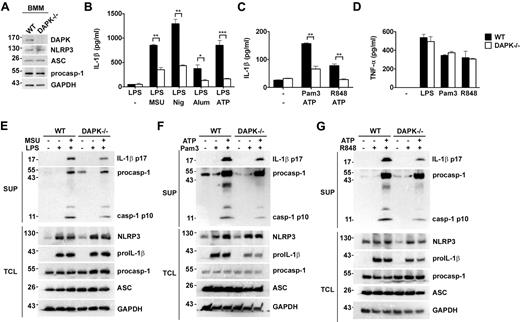 Figure 1. Attenuated caspase-1 activation and IL-1β secretion in Dapk−/− macrophages. (A) Normal expression of NLRP3, ASC, and procaspase-1 in DAPK-null macrophages. Bone marrow–derived macrophages (BMM) from normal littermate control (WT) and Dapk−/− mice were analyzed for the protein expression of DAPK, NLRP3, ASC, procaspase-1, and glyceraldehyde-3-phosphate dehydrogenase (GAPDH). (B-C) Reduced IL-1β secretion in DAPK-null macrophages. Bone marrow–derived macrophages from WT and Dapk−/− (−/−) were primed with LPS (0.5 μg/mL) (B), Pam3CSK4 (Pam3, 1 μg/mL), or R848 (2 μg/mL) (C) for 4 hours, followed by incubation with ATP (5mM) for 60 minutes (B-C), or nigericin (10μM), MSU (150 μg/mL), alum crystal (500 μg/mL) (B) for 6 hours. The secreted IL-1β in the supernatants was determined by ELISA. (D) Normal TNF-α secretion in DAPK-deficient macrophages. Bone marrow–derived macrophages from WT and Dapk−/− mice were stimulated with LPS, Pam3CSK4, and R848 for 6 hours, and TNF-α secreted measured by ELISA. (E-G) DAPK deficiency decreased caspase-1 activation. Macrophage and supernatants from LPS-primed and MSU-stimulated (E), Pam3CSK4-primed and ATP stimulated (F), and R848-primed and ATP stimulated (G) macrophages were collected before and after priming, and after MSU or ATP treatment. Cells were lysed to generate total cell lysates (TCL). Supernatants (SUP) were precipitated with cold (−20°C) acetone, and dissolved in ristocetin-induced platelet aggregation buffer. Both supernatant precipitates and cell lysates were resolved by SDS-PAGE. The amounts of pro-IL-1β, mature IL-1β (p17), NLRP3, ASC, procaspase-1, active caspase-1 (p10), and GAPDH in SUP and TCL were determined by immunoblotting. (B-D) Error bars represent SD of a specific experiment with triplicate samples. All experiments have been repeated at least 3 times with similar results. *P < .05, **P < .01, ***P < .001 for paired t test.