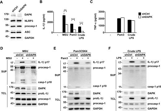 Figure 2. Down-regulation of DAPK in THP-1 decreases caspase-1 activation and p17 IL-1β generation, but not TNF-α production. (A) DAPK knockdown did not affect the expression of NLRP3, ASC, and procaspase-1. THP-1 cells were infected with lentivirus (pLL3.7) containing DAPK-specific shRNA (shDAPK) or control shRNA (shCtrl), the infected cells were sorted, and the contents of DAPK, NLRP3, ASC, and procaspase-1 determined by immunoblots. (B-C) Down-regulation of DAPK decreased secretion of IL-1β but not TNF-α. Control and DAPK-knockdown THP-1 cells, pretreated with PMA (500 ng/mL) for 3 hours and cultured overnight, were stimulated with or Pam3CSK (Pam3, 0.5 μg/mL) or crude LPS (15 μg/mL) for 5 hours, MSU (150 μg/mL) for 6 hours, after which cells and supernatants were collected. The levels of IL-1β (B) and TNF-α (C) in supernatants were determined by ELISA. (D-F) Reduced generation of p17 IL-1β and p10 caspase-1 in DAPK-knockdown THP-1 cells. Cell supernatants (SUP) from panel B were precipitated by cold acetone and analyzed, together with total cell lysates (TCL) from panel B, by SDS-PAGE. The contents of pro-IL-1β, active IL-1β, procaspase-1, active caspase-1, and GAPDH in THP-1 stimulated with MSU (D), Pam3CSK (E), or crude LPS (F) were determined by blotting with specific antibodies. Error bar represents SD of a specific experiment of triplicate samples. All experiments have been repeated 3 times with similar results. **P < .01, ***P < .001 for paired t test.