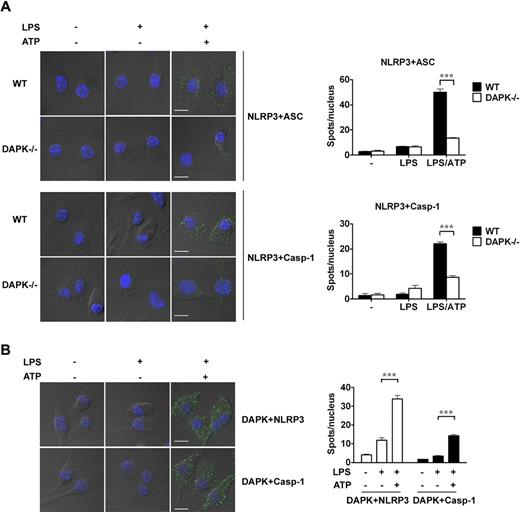 Figure 7. LPS/ATP-induced association of NLRP3, ASC, and procaspase-1 requires DAPK in macrophages. (A) Formation of inflammasome measured by the association of NLRP3 and ASC in LPS/ATP-treated macrophages. Bone marrow-derived macrophages (2 × 105) were seeded overnight, treated without or with LPS, followed with or without addition of ATP. Macrophages were stained with anti-NLRP3 and anti-ASC antibody pair, or anti-NLRP3 and anti-caspase-1 antibody pair overnight at 4°C. Macrophages were then incubated with oligonucleotide-conjugated antimouse antibodies and antirabbit antibodies. The primers were then annealed, circularized, and amplified via rolling-circle amplification. Images were obtained on a Zeiss Axioplan 2 imaging microscope with objective lens of plan-Apochromat 63×/1.4 oil DIC at room temperature. Samples (fixed macrophages) were mounted on Duolink mounting medium. Texas Red–conjugated probe was detected using filter set of 598 nm (Ex) and 613 nm (Em), whereas DAPI-bound DNA was detected using filter set of 360 nm (Ex) and 460 nm (Em). The pinholes are Ch3-1:106 (red), Ch2-2:82 (blue), and ChD-3.0. Images were acquired by LSM 510 META (Zeiss) digital camera using Zeiss LSM Image Browser Version 4.2.0.121 software. For quantitation, individual amplicons were counted in 5 different fields and divided by the number of cells to obtain spots/nucleus. (B) Association of DAPK and NLRP3 in LPS/ATP-stimulated macrophages. Bone marrow-derived macrophages were treated as in panel A, incubated with anti-DAPK and anti-NLRP3, or anti-DAPK and anti–caspase-1, and the proximity of DAPK to NLRP3 detected as in panel A. ***P < .001 for paired t test.