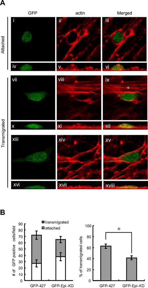 Figure 6. Epithin enhances transendothelial migration. (A) GFP-427 or GFP-427 Epi-KD cells were seeded on a confluent monolayer of MS1 cells. After incubation for 8 hours, the cells were fixed and stained for F-actin with rhodamine-conjugated phalloidin. Based on their morphology visualized by GFP and F-actin, round-shaped cells were counted as attached cells and spindle- or polygonal-shaped cells were counted as transmigrated cells. The representative images of attached (i-iii) and transmigrated (vii-ix,xiii-xv) cells in a sequence of the event are shown. Green represents the GFP signal (i,iv,vii,x,xiii,xvi); and red, the F-actin staining (ii,v,viii,xi,xiv,xvii) in the merged image (iii,vi,ix,xii,xv,xviii). Vertical images (iv-vi,x-xii,xvi-xviii) are also shown to visualize the height of the GFP-positive cells. (ix) *Actin stress fiber. (B) The mean values of the number of attached cells or transmigrated cells per field from 3 independent experiments are shown as bar graphs (left). The percentage of the number of transmigrated cells to the total number of transmigrated and attached cells is shown in each cell type (right). Error bars represent the SD. *P < .001.