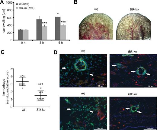 Figure 5. In Btk-deficient mice, the deposition of IC does not lead to tissue infiltration by neutrophils or vascular destruction. The Arthus reaction was elicited in the left ear of wild-type (wt) or Btk-deficient (Btk-ko) mice. (A) By measuring ear thickness, ear swelling was assessed as a parameter of edema and infiltration. Data presented are mean values of ear thickness (± SD). (B) After 8 hours, pictures of the treated ears of wild-type (wt) or Btk-deficient (Btk-ko) mice were taken for (C) the semiquantitative scoring of petechiae and hemorrhage as a marker of progressive, extensive vascular damage. (D) Eight hours after the Arthus reaction was elicited in wild-type (wt) and Btk-deficient (Btk-ko) mice, ears were harvested, embedded, and processed for immunofluorescence analyses. Slides were stained with anti–Gr-1-FITC, anti-CD31+anti-PE, and DAPI. Arrowheads indicate the position of neutrophils.