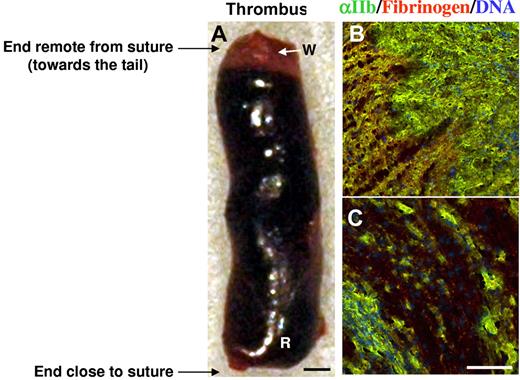 Figure 2. IVC stenosis induces formation of human-like deep vein thrombi in WT mice. Stenosis of IVC was applied in WT mice, and a typical thrombus formed in 48 hours is presented (A). “White” (W) and “red” (R) regions of the thrombus are indicated. Bar, 500 μm. (B-C) A thrombus obtained in the stenosis model was longitudinally cut and stained for a platelet marker (αIIb, green), fibrinogen/fibrin (red), and counterstained for nuclei (blue). Combined images of the thrombus regions remote from (B) and close to (C) the ligation is shown. Unstained dark area is rich in red blood cells. Bar, 50 μm. Representative photographs are shown, n = 3.