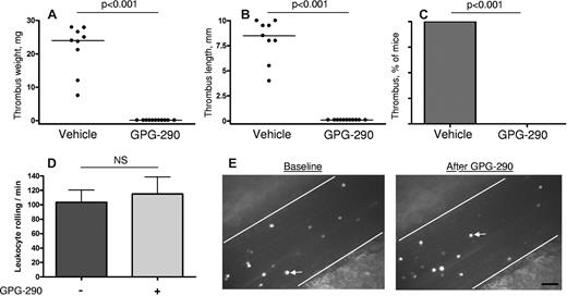 Figure 3. GPG-290 prevents thrombus development in the stenosis model without affecting leukocyte rolling. Stenosis of IVC was performed in WT mice. GPG-290 (100 μg/kg) or sterile saline was infused immediately after operation and again after 24 hours. Thrombi were harvested 48 hours after operation. Values for weight (A) and length (B) of the thrombi are shown with medians (horizontal bars). (C) Incidence of the thrombosis. Vehicle, n = 9; GPG-290, n = 11. (D) Leukocyte rolling was recorded in the same mesenteric vein (diameter 200-300 μm) before and after infusion of GPG-290 (5 mg/kg). No effect of GPG-290 on the number of rolling leukocytes was observed. Results are mean ± SEM, n = 4. (E) Representative photographs of rolling leukocytes in a mesenteric vein before and after infusion of GPG-290. White arrow indicates a rolling leukocyte. Bar, 50 μm.