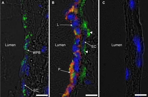 Figure 4. Weibel-Palade body release in IVC endothelium after flow restriction. IVCs from WT mice 6 hours after stenosis had been applied were rapidly excised and snap-frozen in Optimal Cutting Temperature compound (Tissue-Tek). The part of IVC within 2 mm from the stenosis site was sectioned, immunostained for VWF (green), platelet αIIb (red), counterstained for nuclei (blue), and photographed by an inverted fluorescent microscope. Two types of endothelial zones were observed after 6 hours of stenosis: (A) a nonactivated endothelial zone with the typical WPB (green, WPBs) staining pattern and (B) a zone of activated endothelium with no obvious WPB staining. Leukocytes (L) and platelets (P) are adherent to the endothelial cell layer (EC) only in panel B. Subendothelially located VWF is designated with arrowheads. (C) Control staining with nonspecific IgG used instead of primary antibodies. Representative images of 3 mice are shown. Bar, 10 μm.