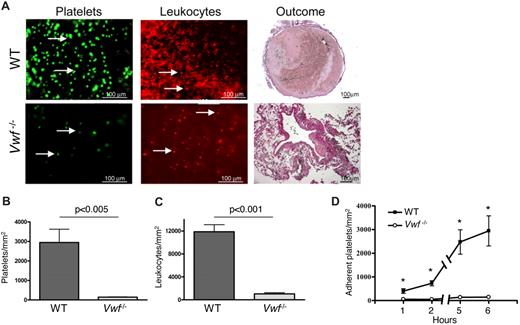 Figure 5. Platelet and leukocyte recruitment is impaired in VWF−/− mice. (A) IVC stenosis was produced in WT (top row) and VWF−/− (bottom row) mice. After 6 hours, fluorescently labeled platelets or Rhodamine 6G were intravenously infused, and the cell accumulation at the area 1-2 mm below the IVC suture (toward the tail) was examined by intravital microscopy using a fluorescent microscope at ×20 magnification. Outcome: thrombus formed within 48 hours after IVC stenosis induction in a WT but not a VWF−/− mouse. (B-C) Quantification of adherent platelets and leukocytes, respectively, 6 hours after flow restriction. (D) Kinetics of platelet accumulation 1-6 hours after flow restriction in the IVC in WT and VWF−/− mice. Data are shown as mean ± standard error of the mean. *Statistically significant difference between WT and VWF−/− mice. WT, n = 8-10; VWF−/−, n = 3.
