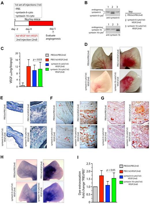 Figure 6. Expression of syntaxin 6-cyto in mice blocks VEGF164-induced angiogenesis and permeability. (A,G) Mice in each group (all of which were Nu/Nu mice) were given 2 injections under anesthesia. The first set of injections (1st) was PBS, syntaxin 6-cyto, or syntaxin 16-cyto. The second (2nd) was PBS or Ad-VEGF164, and given 2 days later at the site of first injection as shown in panel A. At 7 days after the first set of injections, animals were euthanized and the ears were either photographed or removed for further processing. (B) Western blot analysis of syntaxin 6-cyto and syntaxin 16-cyto expression in mouse ear lysates prepared 5 days after Ad-VEGF164 treatment as described in panel A. (C) Quantification of VEGF164 levels in ear extracts using the Quantikine Mouse VEGF immunoassay kit (R&D Systems). Values represent mean (± SD) for n = 10 ears, P ≤ .005). (D) Representative images showing gross appearance of angiogenesis in mock, syntaxin 6-cyto– or syntaxin 16-cyto–injected mouse ears, 5 days before Ad-VEGF164 administration. (E,G) Ears were collected and processed for detailed histologic assessment. (E) Representative images showing staining of 1-μm Epon spur sections stained with Toludine blue. Vertical line marks extent of edema developed after different treatments. (F-G) Immunohistochemical staining of mouse ear sections stained with antibodies against CD31 (F) or VEGFR2 (G). Red arrowheads mark blood vessels developed after different treatments. (H,I) In an experiment similar to that described in panel C, mice treated 5 days before with Ad-VEGF164, were injected with Evans blue dye. (H) Mouse ears were photographed 30 minutes after injection, and representative images are shown. (I) Quantification of dye extravasation, carried out in another group of mice that were euthanized. Ears were removed and Evans blue dye was extracted and measured spectrophotometrically. Quantitated values represent mean (± SD) for n = 10 ears per data point, P ≤ .03.