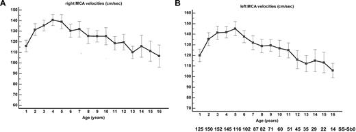 Figure 3. MCA velocities. (A) Right and (B) left TAMMX ( ± SD) MCA velocities at annual check-up.