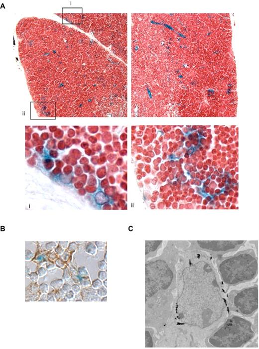 Figure 2. DL4 is expressed abundantly in subcapsular thymic epithelial cells. (A) Thymi from 3- to 6-month-old DL4+/LacZ mice were whole-mount X-Gal–stained, paraffin-embedded, sectioned, and then counterstained with neutral red (i-ii, original magnifications, 100× and 800×). (B) Thymi from 3- to 6-month-old DL4+/LacZ mice were whole-mount X-Gal–stained, sucrose-infused, and embedded in Tissue-Tek optimal cutting temperature compound. Cryosections were stained with anti-cytokeratin 8 (original magnification, 600×). (C) Thymi from 3- to 6-month-old DL4+/LacZ mice stained in whole-mount preparations with Bluo-Gal that was visualized by scanning electron microscopy (original magnification, 10 000×). Images are representative of those obtained from at least 3 mice of each genotype analyzed in a minimum of 3 different experiments.