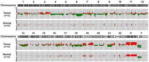 Figure 1. Genome-wide frequency plots of copy number alterations identified in 12 PCNSLs and 13 normal peripheral blood samples.