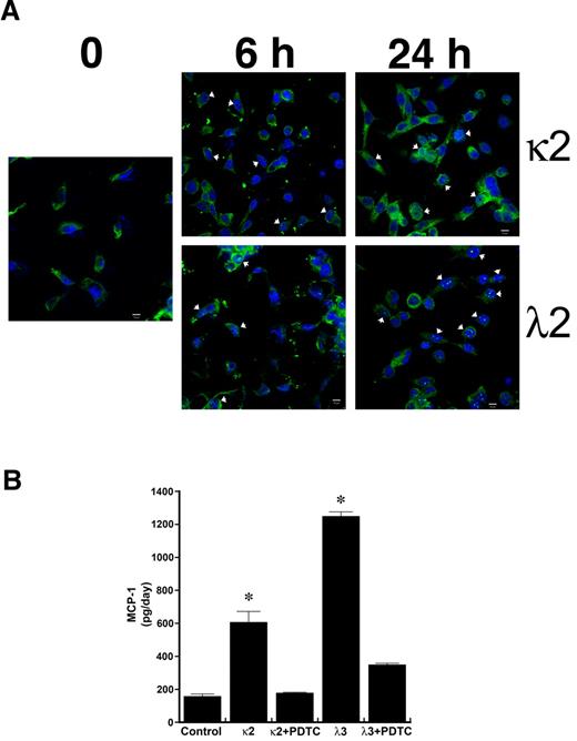 Figure 1. Incubation of human proximal tubular epithelial cells with 2 different monoclonal FLCs (κ2 and λ2) increases the production of MCP-1 through activation of the NF-κB pathway. (A) Confocal laser scanning microscopy using the LSM 710 confocal microscope (Carl Zeiss MicroImaging) and the accompanying LSM 710 ZEN software demonstrated nuclear localization (arrowheads) of RelA (p65) in cells within 6 hours of exposure to κ2 and λ2 FLCs (1 mg/mL). The white bar represents 10 μm. (B) Increase in MCP-1 production induced by 24-hour incubation of renal epithelial cells with the FLCs was inhibited by PDTC, an inhibitor of NF-κB. *P < .05 compared with samples incubated in medium alone (control) and in medium containing the corresponding FLCs and PDTC; n = 6 experiments in each group.