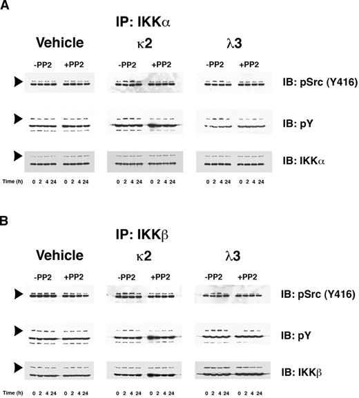 Figure 2. FLCs promote a time-dependent coimmunoprecipitation of IKKα and IKKβ with activated c-Src, which induces tyrosine phosphorylation of these IκB kinases. Renal epithelial cells were incubated with 2 different FLCs (κ2 and λ3) and vehicle. At different time points (0, 2, 4, and 24 hours), the experiments were stopped and cell lysates were produced to immunoprecipitate either IKKα (A) or IKKβ (B). These experiments demonstrated a time-dependent association with activated (phosphorylated) c-Src (top panels) in lysates obtained from cells exposed to the monoclonal FLCs but not medium alone. The approximate 2- to 4-fold increase in association of activated c-Src with the IκB kinases was prevented by the addition of PP2. The middle panels of (A) and (B) demonstrate a contemporaneous 2- to 4-fold increase in tyrosine phosphorylation of the IκB kinases in those cells exposed to the FLCs but not vehicle. The bottom panels demonstrated the presence of similar amounts of IKKα (A) or IKKβ (B) in the immune precipitate. The other major band in the gels represents the heavy-chain component of the antibody used to precipitate the protein complexes.