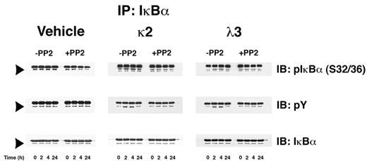 Figure 3. FLCs (κ2 and λ3) induce Src kinase-dependent serine and tyrosine phosphorylation of IκBα in renal epithelial cells. Renal epithelial cells were incubated with 2 different FLCs (κ2 and λ3) and vehicle. At different time points (0, 2, 4, and 24 hours), the experiments were stopped and cell lysates were produced to immunoprecipitate IκBα. Incubation of cells with the FLCs κ2 and λ3, but not the vehicle, promoted a > 2-fold increase in serine phosphorylation of IκBα (top panels), indicating activation of the canonical NF-κB pathway. This effect, which was observed as early as after the first 2 hours of incubation, was inhibited by the Src kinase inhibitor PP2. Both FLCs, but not the vehicle, generated a 4-fold increase in tyrosine phosphorylation of IκBα (middle panels); this was also inhibited by PP2. The bottom panels demonstrate the presence of IκBα in all of the samples studied. The other major band in the gels represents the heavy-chain component of the antibody used to precipitate the protein complexes.