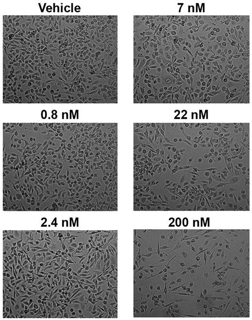 Figure 5. Exposure of renal epithelial cells to PS-341 in concentrations < 22nM does not produce cytotoxicity. To determine the sensitivity of HK-2 cells to PS-341, cells were incubated overnight in medium containing PS-341 in concentrations between 0.8 and 200nM. Although concentrations up to 7mM were well tolerated, cell loss was observed at 22 and 200nM.