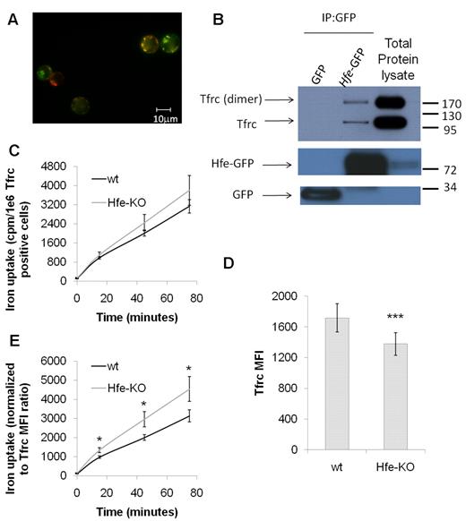 Figure 5. Hfe interacts with Tfrc in erythroid cells and impairs Tf-bound iron uptake. (A) Immunofluorescence of MEL cells showing colocalization (yellow) of Hfe-GFP fusion protein (green) and Tfrc (red). Cells were prepared as described in supplemental Methods. Images were captured on a Nikon TE2000-U inverted microscope equipped with DIC (Nikon), a CoolSnap cf digital camera (Photometrics), and a Plan Apo objective 60×/1.40 oil (Nikon) and acquired using IP Lab Version 3.6.5a software (Scanalytics). Brightness/contrast and color balance were adjusted using Adobe Photoshop Version 7.0.1 (Adobe Systems). (B) Western blot for Tfrc after immunoprecipitation of GFP in protein lysates from MEL cells transduced with lentivirus expressing GFP or Hfe-GFP fusion protein. After stripping, the membranes were blotted for GFP, showing the expected size for GFP and Hfe-GFP in the corresponding lanes. (C) Uptake of 59Fe by wt and Hfe-KO erythroid cells from 59Fe-saturated Tf. Cells were harvested from phlebotomized mice and erythroid cells selected as previously described.30 Counts per minute (cpm) were normalized to the percentage of Tfrc+ cells as detected by fluorescence-activated cell sorter (usually > 85%). Five independent experiments were performed. (D) Tfrc mean fluorescence intensity in isolated erythroid cells shows down-regulation of Tfrc in Hfe-KO cells. Twenty independent measures were made. (E) Iron uptake measured in panel C was normalized to the Tfrc mean fluorescence intensity ratio between wt and Hfe-KO cells for each experiment to control for the differences observed in Tfrc expression. Data are mean ± SEM. *P ≤ .05. ***P ≤ .001.