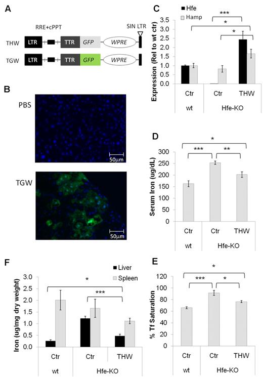 Figure 6. Hepatic injection of a lentivirus carrying the Hfe gene is effective in preventing HH. (A) Schematic representations of the lentiviral vectors THW and TGW. The various components shown are the long terminal repeat (LTR), self-inactivating long terminal repeat (SIN-LTR), the HIV rev-response and central polypurine tract elements (RRE, cPPT), the woodchuck hepatitis virus post-transcriptional regulatory element (WPRE), the liver-specific TTR promoter (TTR), the GFP, and the mouse Hfe gene (Hfe). (B) Representative fluorescence analyses of liver sections from animals 2 months after being transduced with PBS or TGW. Liver was fixed in 4% paraformaldehyde and frozen in OCT embedding medium. Images were captured on a Nikon TE2000-U inverted microscope equipped with DIC, a CoolSnap cf digital camera (Photometrics), and a Plan fluor objective 20×/0.45 (Nikon), and acquired using IP Lab Version 3.6.5a software (Scanalytics). Brightness/contrast and color balance were adjusted using Adobe Photoshop Version 7.0.1 (Adobe Systems). (C) Expression of Hfe and Hamp in the livers of mice injected with lentivirus. (D) Serum iron, (E) Tf saturation, and (F) organ iron content of mice injected with THW together with the appropriate controls. Data are mean ± SEM of 5 or 6 individual age- and sex-matched mice. *P ≤ .05. **P ≤ .01. ***P ≤ .001.