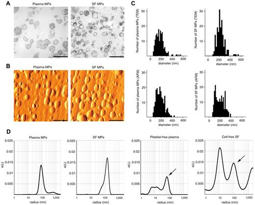 Figure 1. Size determination of MPs. (A) TEM images of healthy blood plasma- and RA SF-derived, isolated MPs. Original magnification × 50 000. Scale bars represent 500 nm. Images were recorded at room temperature using Hitachi 7100 electron microscope equipped with a Megaview II digital camera. (B) Shaded topography AFM images of healthy blood plasma- and RA SF-derived, isolated MPs. Scale bars represent 500 nm. Images were captured at room temperature using a PSIA XE-100 AFM with a XEP1.5 acquisition software. The imaging medium was air. Topography images were processed with XEI 1.6 software using the Sobel Edge Enhancement method. (C) MP size distributions, determined on the basis of TEM and AFM images of 180-180 MPs, are shown by histograms. For the analysis of particles, ImageJ software (Version 1.42q) was used. (D) Analysis of isolated MPs and native biologic samples by DLS. The x-axis is set to logarithmic scale; a(rh) denotes the coefficient of autocorrelation function of the scattered electric field. Arrows indicate peaks corresponding to MPs in the native samples. DLS experiments were carried out at 21°C.