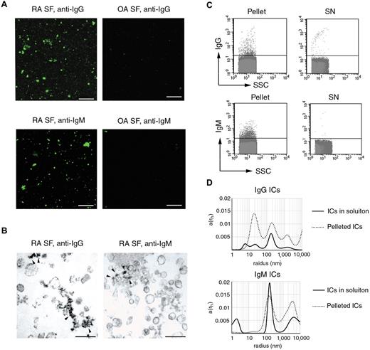 Figure 5. Cosedimentation of ICs and MPs. (A) Fluorescent microscopy images of antihuman IgG-FITC or antihuman IgM-FITC-stained 20 500g pellets from RA and OA SFs. Images were captured at room temperature using a Zeiss LSM 510 Meta confocal laser scanning microscope equipped with an inverted Axiovert 200M microscope, 63× Plan Apochromat oil immersion differential interference contrast objectives (numerical aperture, 1.4). The acquisition software was AIM LSM, Version 4.2. (B) The 20 500g pellet from RA SF was analyzed by immune EM, stained with antihuman IgG-HRP or antihuman IgM-HRP. Arrowheads indicate immunopositive structures among MPs. Original magnification × 50 000. Scale bar represents 400 nm. Images were captured at room temperature using Hitachi 7100 electron microscope equipped with a Megaview II digital camera. (C) FC analysis revealed that isolated ICs were present in the pellet and were nearly absent in the supernatant (SN). (D) Isolated IgG or IgM ICs from RA SFs were also analyzed by DLS. The x-axis is set to logarithmic scale; a(rh) denotes the coefficient of autocorrelation function of the scattered electric field. DLS experiments were carried out at 21°C.