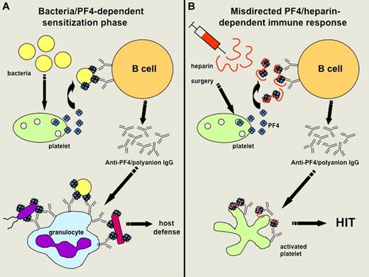 Hypothetical representation. The image shows the hypothetical representation of the mechanisms involved (A) in sensitizing infected patients to PF4 and (B) favoring further development of HIT when treated by heparin (adapted from Krauel et al's Figure 6). (A) Bacteria can induce the release of PF4, which then binds polyanions present on the bacterial surface. This interaction triggers the synthesis of antibodies specific to modified PF4, which can bind to variable bacterial strains and favor their phagocytosis by granulocytes. (B) After initiation of heparin treatment (particularly in surgical patients), PF4/heparin complexes are formed, mimic PF4 bound to bacteria and thus trigger the synthesis of modified PF4-specific antibodies in sensitized patients. Anti-PF4/polyanion IgG antibodies strongly activate platelets in some cases and promote the development of HIT.