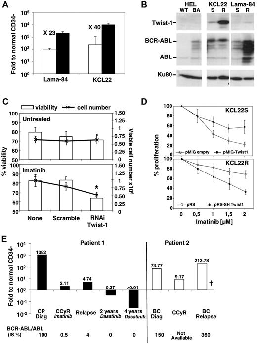 Figure 2. Involvement of TWIST-1 in CML response to TKIs, KCL22, or Lama-84 cell lines was analyzed for TWIST-1 expression. (A) Comparative expression by quantitative PCR of TWIST-1 in Lama-84 and KCL-22 imatinib-sensitive (□) and imatinib-resistant (■) Ph1+ cell lines. Results are expressed as a ratio to normal (healthy donors) CD34− cell values. (B) TWIST-1, BCR-ABL, and KU80 (used as loading control) protein analysis by Western blot in HEL expressing BCR-ABL (BA) or not (WT), KCL-22 and Lama 84 imatinib-sensitive (S) and -resistant (R) cell extracts. (C) Viability and viable cell numbers in untreated and imatinib-treated (1.5μM) Lama84-resistant Ph1+ cell line, submitted to TWIST-1 siRNA or negative scramble as control. Cells were incubated in 96-well plates in serum-free medium with stem cell factor (100 ng/mL), in the presence of 50nM of fluorescent siRNA. Results are presented as a percentage of viable cells or as total viable cell numbers ± SEM. After 2 days of culture, cell proliferation and viability were determined by trypan blue counting. Fold proliferation was determined by reference to the input number of viable cells. Results represent the mean ± SEM of 7 independent experiments. *Significant value (P < .05). (D) TWIST-1 expression in KCL22-resistant cells (KCL22R) transduced with a pSR vector empty or containing sh sequence against TWIST-1 or in KCl22-sensitive cells (KCL22S) transduced with a pMIG vector empty or containing TWIST-1 expressing sequence. After 3 days in the presence of puromycin selection for KCL22R-shTWIST-1 or after 48 hours for KCL22S-TWIST-1, cells were incubated in the presence of imatinib at the indicated dose. After 3 days of culture, cell proliferation and viability were determined by trypan blue counting. The percentage of proliferation was determined by reference to the nontreated number of viable cells ± SEM from 5 experiments. (E) Follow-up analysis for TWIST-1 expression by quantitative PCR in the CD34− fraction. Results are expressed as a ratio to normal (healthy donors) CD34− cell values. The values obtained for the BCR-ABL/ABL ratio are indicated as a percentage (IS) at each data point for both patients. BC indicates blast crisis; and CCyR, complete cytogenetic remission. †Deceased.