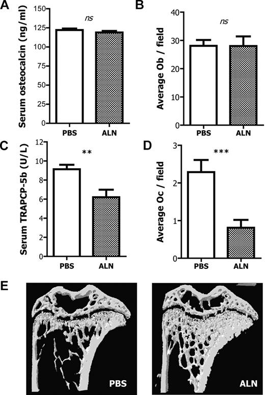 Figure 1. Effects of ALN treatment on bone and bone cells. (A) ALN-treated and untreated mice have comparable levels of blood serum osteocalcin as measured by ELISA. Columns represent mean plus or minus SEM; n = 8. (B) ALN treatment has no effect on the number of osteoblasts per field as measured by histomorphometry. (C) Blood serum TRAPCP-5b concentration is reduced in the ALN-treated mice compared with the untreated controls as measured by ELISA. Columns represent mean ± SEM; n = 8. (D) ALN treatment reduces the number of osteoclasts per field as measured by histomorphometry. (E) Representative three-dimensional reconstruction models of tibias from ALN-treated or untreated mice, indicating that in vivo administration of ALN increases the bone mass and alters the bone microarchitecture. ns indicates not significant.