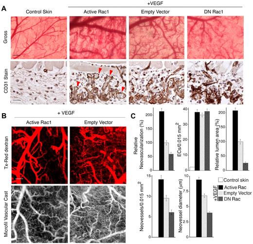 Figure 1. Active Rac1 improves neovessel architecture and lumen formation in vivo. (A) VEGF165 transfectants were mixed with packaging cells expressing retrovirus encoding active L61Rac1, dominant-negative N17Rac1, or empty vector (control) and injected together with Matrigel subdermally. Animals were harvested after 7 days. Gross: gross images of dermis overlying the Matrigel implants show that active L61Rac1 improved formation of new blood vessels relative to control, whereas DN Rac1was inhibitory. Scale bar = 375 μm. CD31 Stain: ECs in cross section stained with CD31 antibody (brown color), illustrating that active Rac1 improved lumen formation (arrows) relative to empty vector control, whereas DN Rac1 abolished lumen formation. Scale bar = 15 μm. (B) Tx-Red dextran: perfusion of vessels with 70 kDa, lysine-fixable, Texas-Red dextran (10 minutes), viewed with confocal microscopy (scale bar = 300 μm) confirming that active Rac1 promoted formation of larger, well-perfused, architecturally improved blood vessels. Microfil Vascular Cast: the entire vasculature was perfused with Microfil, illustrating improvement in neovessel diameter and architecture mediated by active Rac1 (scale bar = 250 μm). (C) Quantification of vascular parameters; n > 20 for all groups. From gross images: relative neovascularization (ie, percentage of relative area occupied by neovessels in flat mount; P < .001). From CD31-stained cross-sections: quantification of ECs per 0.015 mm2, relative total lumen area (P < .001), numbers of neovessels per 0.015 mm2 (P < .01), and average internal neovessel diameter (P < .01).
