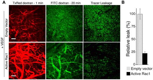 Figure 2. Active Rac1 reduces neovessel leakiness associated with VEGF-driven pathologic angiogenesis. (A) VEGF165 transfectants were mixed with packaging cells expressing retrovirus encoding active L61Rac1 or empty vector (control) and injected together with Matrigel subdermally. Seven days later neovessel leakiness was assessed by confocal microscopy. Intravascular tracer was visualized with Texas Red-dextran (molecular weight, 70 kDa) injected 1 minute before killing (left). FITC-dextran (molecular weight, 70 kDa) injected 20 minutes before killing was used to visualize the sum of (intravascular tracer + extravascular tracer) (center). The extent of tracer extravasation was determined by subtracting the Texas Red signal from the respective FITC-dextran signal to yield the signal for extravascular tracer corresponding to tracer leakage (right). (B) Quantification of tracer leakage was achieved by integrating the signal intensities for the resultant extravasated tracer (n = 4 for both groups). Active Rac1 reduced tracer leakage > 4-fold. Scale bar = 200 μm.