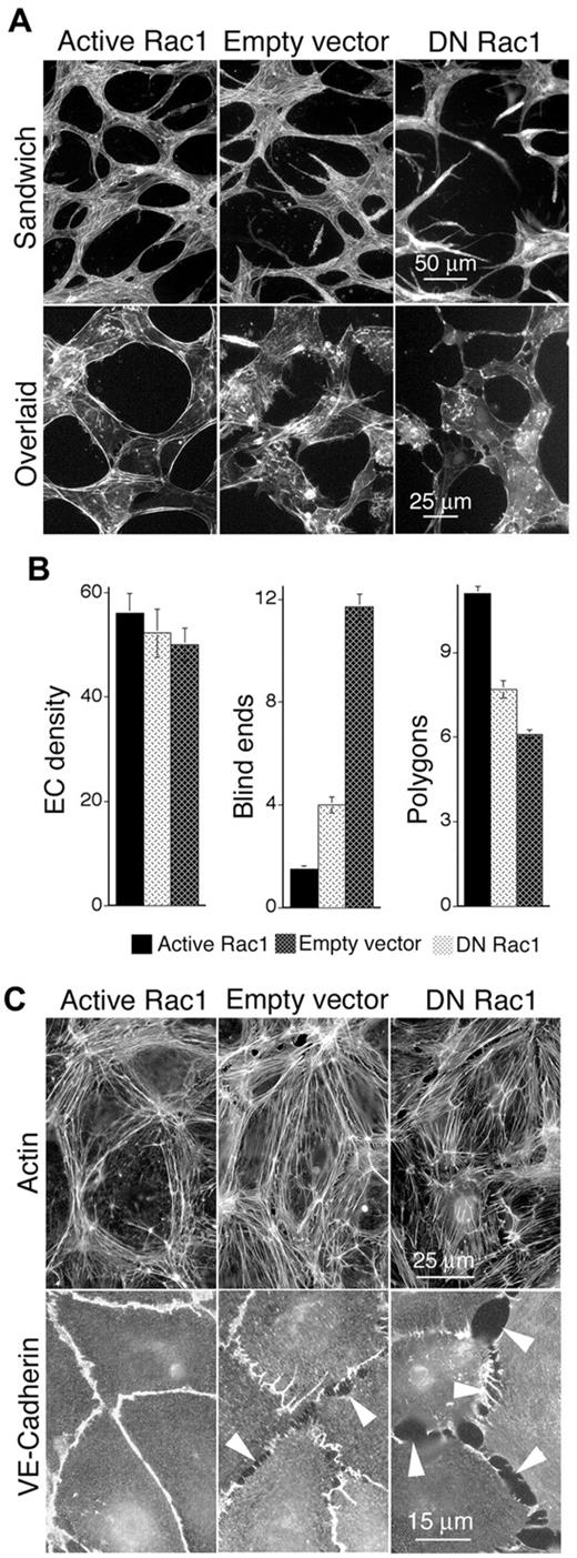 Figure 3. Active Rac1 improves formation of vascular cords, organizes actin filaments cortically, and improves EC-EC junctions in vitro. (A) Dermal MVECs, transduced with Rac1 mutants or empty vector control, were induced to undergo capillary morphogenesis (cord formation, see “Methods”) by sandwiching between 2 layers of collagen I (top) or overlaying with collagen I (bottom). Subsequently cells were stained for F-actin. Top panels: note abundance of cord blind ends in DN Rac1 and control specimens that are absent in the active Rac1 specimen. Bottom panels (higher magnification): note cortical distribution of actin filaments in MVECs transduced with active Rac1, whereas actin is poorly organized in MVECs transduced with empty vector control or DN Rac1. (B) Quantification of cord parameters; n > 20 for all groups. Relative to controls, active Rac1 strongly reduced cord blind ends (P < .001) and increased cord integration as measured by counting closed polygons (P < .01), whereas DN Rac1 increased cord blind ends and reduced cord integration (polygons). (C) Confluent monolayers of MVECs, cultured in the presence of 20 ng/mL VEGF, and stained for F-actin (top panels) or VE-cadherin (bottom). Relative to empty vector control, active Rac1 strongly organized actin filaments cortically and improved integrity of EC-EC junctions as shown by VE-cadherin staining. DN Rac1 had opposite effects.