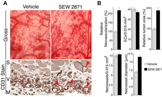 Figure 5. Administration of SEW2871 improves VEGF-driven angiogenesis in vivo. Mice were treated daily with SEW2871, beginning on day 2 after implantation of the VEGF165-transfected cells in Matrigel. (A) As shown grossly at day 7, SEW2871 improved formation of neovessels (scale bar = 450 μm). In addition, as viewed in cross-sections stained for CD31, neovessels with well-developed lumens were most abundant in the SEW2871 group. S indicates skeletal muscle layer; V, vessels, M, Matrigel; scale bar = 25 μm. (B) Quantification of vascular parameters (n > 20 for all groups). From gross images: relative neovascularization, (ie, percentage of relative area occupied by neovessels in flat mount, P < .001). From CD31-stained cross-sections: quantification of ECs per 0.01 mm2 relative total lumen area (P < .001), numbers of neovessels per 0.015 mm2 and average internal neovessel diameter (P < .001).