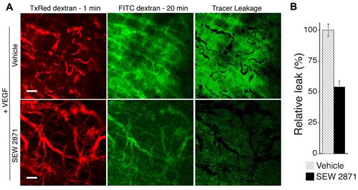Figure 6. SEW2871 reduces neovessel leakiness associated with VEGF-driven pathologic angiogenesis. (A) Mice were treated daily with SEW2871 or vehicle, beginning on day 2 after implantation of the VEGF165-transfected cells in Matrigel. Six days later vessel leakiness was assessed by confocal microscopy. Intravascular tracer was visualized with Texas Red-dextran (molecular weight, 70 kDa) injected 1 minute before killing (left). FITC-dextran (molecular weight, 70 kDa) injected 20 minutes before killing was used to visualize the sum of (intravascular tracer + extravascular tracer; center). The extent of tracer extravasation was determined by subtracting the Texas Red signal from the respective FITC-dextran signal to yield the signal for extravascular tracer corresponding to tracer leakage (right). (B) Quantification of tracer leakage was achieved by integrating the signal intensities for the resultant extravasated tracer (n = 4 for both groups). Active Rac1 reduced tracer leakage > 2-fold. Scale bar = 200 μm.