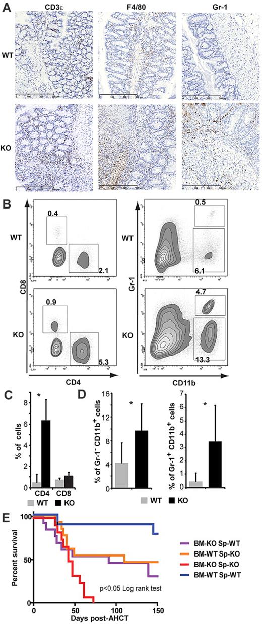 Figure 4. SMAD3 deficiency in both T and non-T cells contributes to lethal GVHD. (A) Representative photographs of colon sections stained with anti-CD3ϵ, anti-F4/80, and anti-Gr-1 (100-μm scale unit). Virtual slides were scanned with the NanoZoomer, Version 2.0 series system and acquisition software NDP.scan, Version 2.2.17 (Hamamatsu Photonics) using a 40× objective lens. (B) One representative plot of CD8/CD4 and Gr-1/CD11b staining of colon cells. (C) Mean percentages of CD4+ and CD8+ cells and (D) of granulocytes (CD11b+/Gr-1+) and monocytes (CD11b+/Gr-1−) among the live gate. All histograms represent means with error bars representing SEM. Statistical analyses were performed with Student t test: *P < .05. (E) Splenocytes from either WT or SMAD3-KO mice were admixed to T cell-depleted BM from WT or SMAD3-KO 129-strain donors and injected into BALB.B recipients. Survival curves were analyzed using the log-rank test. Survival of mice that received mixed grafts (in which only the BM or the spleen cells were from SMAD3-KO donors) was better than for recipients of SMAD3-KO graft (P < .05), but worse than for recipients of WT graft (P < .05).