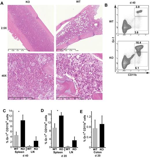 Figure 6. SMAD3 deficiency leads to systemic accumulation of granulocytes in AHCT recipients. (A) Representative images of day 40 BM at 2 magnifications (original magnification ×2.5, 0.25-mm scale unit; and original magnification ×40, 20-μm scale unit). Virtual slides were scanned with the NanoZoomer, Version 2.0 series system and acquisition software NDP.scan Version 2.2.17 (Hamamatsu Photonics) using a 40× objective lens. (B) Representative contour plots (spleen) and (C-E) overall percentages (mean and SEM) of granulocytes (CD11b+/Gr-1+) in the spleen and mesenteric lymph nodes (C) on day 40 (n = 12 and 5, respectively) and (D) on day 20 (n = 8 and 5, respectively) after AHCT. (E) Mean percentage of granulocytes (CD11b+/Gr-1+) in the colon on day 20 after AHCT (n = 6). Statistical analyses were performed with Student t test: *P < .05.