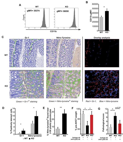 Figure 7. SMAD3-KO granulocytes cause tissue damage in the colon. (A) Representative CD11b staining and (B) average CD11b geometric mean fluorescence intensity of granulocytes extracted from the colon of AHCT recipients on day 40 (mean and SEM, n = 9). (C) Representative images (following Visiopharm software analysis) of consecutive tissue sections stained for Gr-1 (red) or nitrotyrosine (blue); overlay created using the Adobe Photoshop, Version CS3 software. Representative images were taken from virtual slides that were scanned with the NanoZoomer, Version 2.0 series system and acquisition software NDP.scan, Version 2.2.17 (Hamamatsu Photonics) using a 40 × objective lens. Analysis of positively stained cells (green) was done using Visiopharm Integrator System, Version 3.4.1.0 MicroImager (Visiopharm) software. Overlay analysis of consecutive tissue sections stained for Gr-1 or nitrotyrosine were photomerged and analyzed using the Adobe Photoshop, Version CS3 software. (D) Percentage of Gr-1+ and nitrotyrosine+ cells (mean and SEM, n = 3; 10 fields at a 20× original magnification). (E) Percentage of nitrotyrosine-positive cells that are adjacent to granulocytes (≤ 30 pixels). (F) Average weight (with SEM) for surviving mice (minimum of 6 mice per group) at day 40 after AHCT. (G) Pathologic grading of large bowel GVHD (n = 6-9). Statistical analyses were performed with Student t test: *P < .05, **P < .01.