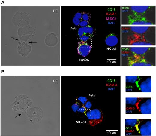 Figure 6. Colocalization of CD18 with ICAM-1 and with ICAM-3 in the contact regions of neutrophils/slanDCs and neutrophils/NK cells, respectively. (A-B) Neutrophil/NK cell/slanDC cocultures were incubated with LPS + IL-15/IL-18 prior to preparing the samples for confocal microscopy analysis as described in “Laser confocal microscopy.” The contact regions between neutrophils and slanDCs (A) and neutrophils and NK cells (B) are shown by bright-field images (BF; left panels). Overlay of fluorescent images (middle and right panels) demonstrate the colocalization of (A) CD18 (green) and ICAM-1 (red) and of (B) CD18 (green) and ICAM-3 (red) in the contact regions between neutrophils and slanDCs, and neutrophils and NK cells, respectively. Representative images from 3 experiments for each condition are shown.