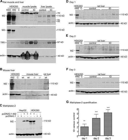 Figure 5. Western blot analysis of matriptase-2 protein in rat liver tissues. (A) Western blot analysis of matriptase-2 (M2), TfR1, and β-actin in rat muscle and whole liver tissues. Gastrocnemius muscle and liver extract proteins (250 μg) from rats fed either a control diet (control) or an ID diet for 3 days were separated by use of 11% SDS-PAGE under reducing conditions, followed by transfer onto nitrocellulose membrane. Membranes were probed with rabbit anti–matriptase-2 (M2), mouse anti-TfR1 (TfR1), and mouse anti–β-actin, followed by immunodetection with corresponding HRP-conjugated secondary antibodies. The blot was exposed to X-ray film. Cell lysates (100 μg protein per lane) from HEK293 cells transiently transfected with either empty vector (C), human TMPRSS6 cDNA (hM2), or rat TMPRSS6 cDNA (rM2) were included as the negative and positive controls, respectively. Two images for matriptase-2 (M2) with different exposure time (top and middle panels) were presented to show the M2 bands in transfected cells. Note that muscle lysates have high levels of β-actin. (B) Western blot analysis of matriptase-2 (M2) and β-actin in mouse liver tissues. Liver membrane extract proteins (250 μg) from 2 8-week-old Tmprss6−/− mice (−/−) and 2 age- and sex-matched wild-type counterparts (wt) were separated with 11% SDS-PAGE under reducing conditions, followed by transfer onto nitrocellulose membrane. Membranes were probed with rabbit anti–matriptase-2 (M2) and mouse anti–β-actin, followed by immunodetection with corresponding HRP-conjugated secondary antibodies. The blot was exposed to X-ray film. Cell lysates (100 μg protein per lane) from HEK293 cells transiently transfected with either empty vector (C) or rat TMPRSS6 cDNA (rM2) were included as the negative and positive controls, respectively. Experiments were repeated twice with consistent results. (C) Western blot analysis of matriptase-2 (M2) and β-actin in HepG2 and HEK293 cells. HepG2 and HEK293 cells in 12-well pates were transiently transfected with either pcDNA3.1-human TMPRSS6 (pcDNA3.1-M2) or pcDNA3.1 empty vector with Lipofectamine 2000. At approximately 48 hours after transfection, cell lysates were subjected to 11% SDS-PAGE, followed by immunodetection with rabbit anti–matriptase-2 (M2), mouse anti–β-actin, and the corresponding HRP-conjugated secondary antibodies. The blot was exposed to X-ray film. Experiments were repeated 4 times with consistent results. (D-F) Western blot analysis of matriptase-2 (M2) and β-actin (actin) in rat liver tissue extract proteins (250 μg) from the animals at 1 day (D), 2 days (E), and 3 days (F). Cell lysates (100 μg protein per lane) from HEK293 cells transiently transfected with either empty vector (C) or human TMPRSS6 cDNA (hM2) were included as the negative and positive controls, respectively. Experiments were performed as described previously in panel A. For each set of analyses, both matriptase-2 (M2) and β-actin (actin) images were derived from the same gel. (G) Quantitative immunoblot analysis of matriptase-2 in panels D through F. The quantification of matriptase-2 bands in panels D through F was performed in essentially the same manner as described previously except that fluorescently labeled goat secondary antibody was used. The intensity of each band was recorded as arbitrary units. We first normalized the intensity of the matriptase-2 band by using β-actin as a loading control. The relative amounts of matriptase-2 in the ID group versus in the corresponding control group are presented. The differences between the control and ID groups were evaluated with the 2-tailed Student t test. All the Western blot analyses were repeated at least twice and showed consistent results. hM2, human matriptase-2; rM2, rat matriptase-2; **P < .01; ***P < .001.