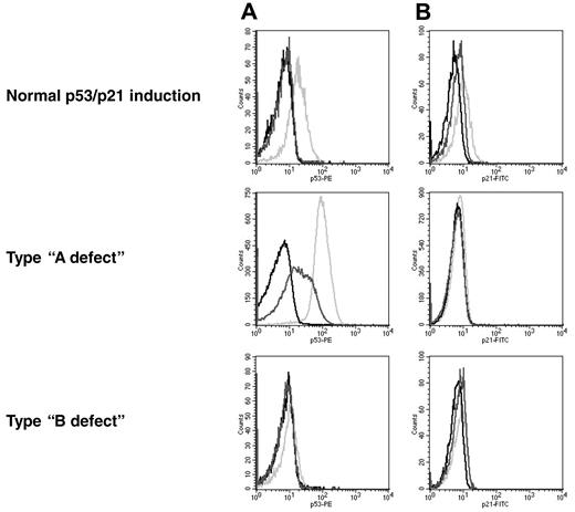 Figure 2. Patterns of response to DNA damage in CLL. The histograms show the levels for p53 (A) and p21 (B). Black line, isotype control; dark gray line, nonirradiated sample; light gray line, irradiated sample. Normal response: low basal levels of p53 and p21 and induction of both proteins after irradiation. Type-A defect: high basal p53 level and impaired p21 induction. Type-B defect: low basal p53 level and impaired p21 induction.