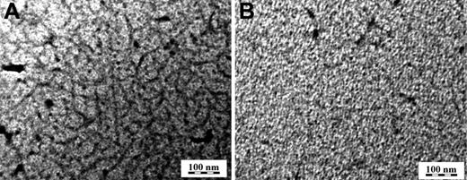 Figure 3. Morphology of fibrinogen-fibrin layers on carbon as observed by TEM. Fibrinogen was adsorbed on carbon-coated mica at a concentration of 20 μg/mL for 150 minutes (A) and 500μg/mL for 30 minutes (B), treated with thrombin at 2.5 U/mL for 60 minutes, a mixture of PPACK at 10μM and hirudin at 6 U/mL for 20 minutes, and fibrinogen at a concentration of 200 μg/mL for 60 minutes. The layers were contrasted with uranyl acetate, dehydrated with a series of water-ethanol solutions, and dried.