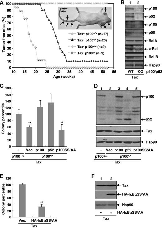 Figure 1. Noncanonical NF-κB is involved in Tax-mediated cellular transformation and tumorigenesis. (A) Kaplan-Meier plot of tumor-free mice. Tax+ p100+/+ mice (n = 17), Tax+ p100−/− mice (n = 20), and Tax-free p100+/+ or p100−/− mice (n = 9) were monitored daily for tumor formation for up to 52 weeks. A representative mouse with tumors is shown (right) and the tumors are indicated by arrows. (B) Protein expression levels of NF-κB proteins in Tax+p100+/+ or Tax+p100−/− tumor cells. (C) Involvement of p52 for Tax-mediated colony formation. The p100−/− MEFs stably expressing Tax alone or together with p100, p52, or p100SS/AA were plated in soft agar for colony formation. The colony formation efficiency is represented as a percentile of that in p100+/+ MEFs stably expressing Tax (arbitrarily set as 100). These data represent mean (± SD) for n = 3 samples. **P < .01. (D) Protein expression levels of Tax, p100, p52, and p100SS/AA in the MEFs stably expressing Tax used in panel C. (E) Suppression of Tax-mediated colony formation by IκBαSS/AA. The p100+/+ MEFs stably expressing Tax alone or together with HA-IκBαSS/AA were plated in soft agar and subjected to colony formation as described in panel C. (F) Protein expression levels of Tax and HA-IκBαSS/AA in the MEFs used in panel E.