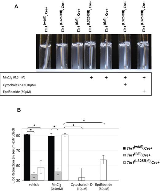 Figure 2. Fibrin clot retraction is impaired in talin1-deficient and talin1(L325R) mutant platelets. (A) Clot retraction of PRP from Tln1(wt/fl),Cre+ or Tln1(L325R/fl),Cre+, or Tln1(fl/fl),Cre+ mice was initiated by 1.0 U/mL thrombin and photographed after 2 hours. As indicated, 0.5mM MnCl2, 10μM cytochalasin D, or 50μM eptifibatide was added to PRP 5 minutes before the addition of thrombin. Efficient clot retraction, visible as a consolidated clot and transparent clot liquor, was observed in PRP from Tln1(wt/fl),Cre+ mice and Tln1(L325R/fl),Cre+ mice in the presence of manganese. (B) Fibrin clot retraction was quantified by calculating the weight of the serum extruded from the clot relative to the initial clot weight and expressed as a percentage. n = 3. *P < .005.