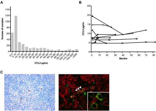 Figure 3. CCL3 plasma levels in CLL: distribution and sequential samples, and CCL3 immunohistochemistry. (A) The distribution of the plasma levels of CCL3 among 351 patients with CLL. (B) Sequential plasma levels of CCL3 detected in serial samples of CLL patients. The lines connect the symbols of individual patients representing the CCL3 concentrations (y-axis) in any one patient over time (x-axis). (C) Conventional (left) and immunofluorescence (right) immunodetection of CCL3 in CLL lymph node sections in a representative case (original magnification ×400). Images were captured with the use of an Olympus BX50 microscope and a ColorView digital camera, and processed with cellSens imaging software (all Olympus). CCL3+ cells (brown stain on the left side) tended to accumulate in areas of proliferation centers (left). Immunofluorescence double staining with CD79a (red) and CCL3 (green) revealed colocalization of CD79a+ and CCL3+ CLL cells, as indicated by the arrows. (Inset) Coexpression of CCL3 and CD79a in another case. More immunohistochemistry data are available in supplemental Figure 2.