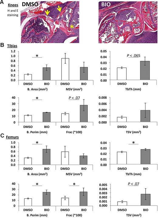 Figure 4. Histomorphometric scoring of hind limb bones adjacent to tumors in mice treated with a peritumoral dose of BIO or vehicle (DMSO). (A) Example of sections used for the histomorphometric scoring, demonstrating tibial and femoral destruction in untreated but INA6-engrafted knees. Note destruction of the bone at the articular surfaces of the knee (arrowed) and disruption of the trabecular structures that is less apparent in the BIO-treated animals (asterisk). (B) Static histomorphometric assays of peritumoral bone tissue in INA6 bearing mice locally treated with BIO or with vehicle (DMSO). The bone area (B. Area), marrow star volume (MSV), trabecular thickness (Tb. Th.), trabecular star volume (TSV), bone perimeter (B. Perim), and percentage of bone/total tissue (frac × 100) are shown. Bars represent mean (± SEM) for n = 4-5 samples. *P < .05 with Student t test. Where values for P were borderline significant, they are given on the plot. Experiment was performed twice.