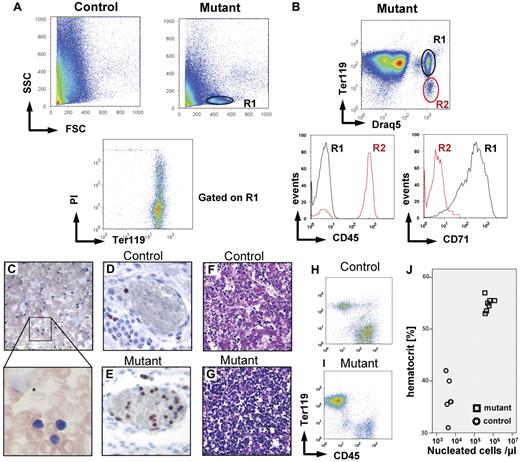 Figure 6. Dysregulated erythopoiesis in kitD814Vflox deleter-Cre neonatal mice. The kitD814Vflox deleter-Cre genotype, which results in early and general deletion of the stop element and expression of kitD814V in all cells expressing wt kit, causes perinatal lethality in approximately 75% of newborn mice and is associated with a hyperproliferative dysregulation of the erythroid lineage. (A) FACS analysis of peripheral blood from newborn mutant animals displays an abnormal population of small, nongranulated cells (region R1). Gating on this population (lower panel) reveals that these cells express the erythroid marker Ter119 and that approximately 50% of the cells take up the dye propidium iodide and are therefore dying or dead. (B) Positive staining with the cell-permeant dye Draq5 provides additional evidence that this population (R1) does not represent normal erythrocytes but indeed nucleated cells. These cells also express the transferrin receptor (CD71) but not CD45 (bottom panel). Blood smears (C, 40×/0.75 objective and 63×1.3 NA oil objective) show large numbers of small cells with dense nuclei and sparse basophilic cytoplasm resembling erythroblasts, but also numerous nuclear shadows (*) represent remnants of cells, indicating the presence of a cell population with increased mechanical fragility. Whole-mount sections of bitransgenic newborns demonstrate drastically increased numbers of nucleated Ki67 cells in blood vessels (Ki67 immunostaining: D, control; E, mutant, 20×/0.7 NA objective). The liver of the bitransgenic mice (F, mutant; G, control, 20×/0.7 NA objective) contained a massively increased number of hematopoietic cells (dense, dark blue nuclei, hematoxylin and eosin staining). Flow cytometry of fetal liver homogenates for the markers CD45 and Ter119 gated on DNA containing cells reveals an increase of nucleated Ter119+ cells within the liver of kitD814Vflox deleter-Cre mutants (I) versus control (H). Dramatic increase in hematocrit (J) in mutants (☐) versus control animals (○).