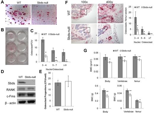 Figure 1. Sbds is required for in vitro and in vivo OCG. (A) Photomicrographs of TRACP-stained osteoclasts derived from WT and Sbds-null mice after 6 days in culture with RANKL and M-CSF (both original magnification ×200). Significantly more large multinucleated osteoclasts were observed in WT cultures. (B) The marked difference in OCG between WT and SBDS-null cultures is visible to the eye. Shown are cultures derived from 3 separate WT (left) and Sbds-null (right) mice. (C) The number of osteoclasts and the number of nuclei per osteoclast were quantified. Sbds-null osteoclast cultures exhibited decreased OCG compared with WT cultures, as shown by significantly lower numbers of small (3 or 4 nuclei/osteoclast), medium (5-7 nuclei/osteoclast), and large (≥ 8 nuclei/osteoclast) osteoclasts (n = 8): *P < .01. (D) Western blots showing that Sbds was deleted from Sbds-null monocytes. Levels of RANK and c-Fms between WT and Sbds-null cells were similar after 2 days of culture with RANKL and M-CSF. β-actin was used as a loading control. (E) There was no difference in osteoclast progenitor levels between WT and Sbds-null mice as measured by a colony-forming assay after 10 days in culture with M-CSF and RANKL (n = 3): P > .05. (F) Photomicrographs of TRACP-stained distal femoral bone sections at low magnification (original magnification ×100), and the boxed areas at high magnification (original magnification ×400), representative of more intense staining in WT sections. Osteoclasts were quantified in 3 bone sections per mouse and 3 mice per genotype (right). Significantly more small, medium and large osteoclasts were counted in WT sections (n = 3): *P < .001; **P < .005. (G) DXA analysis of age-matched female animals showed that WT mice had significantly higher BMD (top panel) and BMC (lower panel) in the whole body, lumbar vertebrae, and left femur than Sbds-null mice (n = 6): *P < .01; **P < .005.