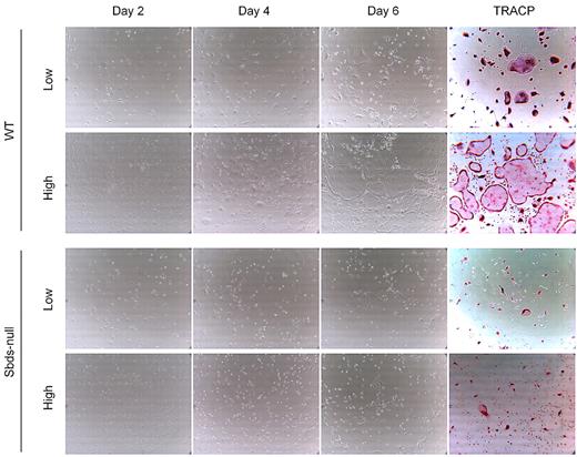 Figure 3. Sbds-null monocytes lack the ability to fuse even at high cell densities. Monocytes were cultured at 2 initial plating densities in 6-well plates, low (5 × 104 cells/well) and high (2.5 × 105 cells/well), to observe the effects of cell density on OCG. Representative photomicrographs (original magnification ×200) of WT (top 2 panels) and Sbds-null (lower 2 panels) cultures are shown on days 2, 4, and 6 of OCG, and representative TRACP-stained images of day 6 WT and Sbds-null cultures are shown on the right. At the 5-fold-higher initial plating density, WT cells formed clearly more large multinucleated osteoclasts than at the lower density. However, this increase in OCG was not observed for Sbds-null cells, suggestive of a fusion defect.