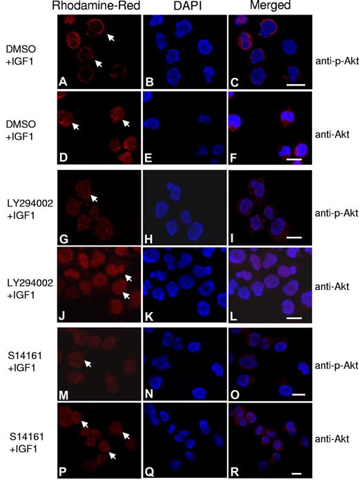 Figure 5. S14161 inhibited phospho-AKT translocation and accumulation at the cytoplasmic membrane. OPM2 myeloma cells were starved overnight, followed by treatment with S14161 (100μM for 1 hour), LY294002 (100μM for 30 minutes), or DMSO control for 1 hour. Cells were then treated with 100 ng/mL IGF1 for 10 minutes. Cells were fixed and stained with antibodies against AKT or phospho-AKT (p-AKT) and DAPI (4,6 diamidino-2-phenylindole) as described in “Immunofluorescence assay.” Red indicates AKT or p-AKT; blue, nuclei. (A-C) Phospho-AKT (arrows) stimulated by IGF; (D-F) total AKT translocated to the plasma membrane after IGF1 treatment; (G-I) Phospho-AKT inhibited by LY294002; (J-L) total AKT located in the nuclei after LY294002 treatment; (M-O) phospho-AKT inhibited by S14161; and (P-R) total AKT was restricted to the nuclei after S14161 treatment.