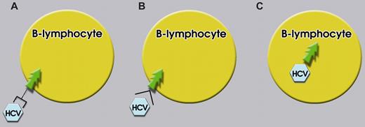 Figure 1. Three pathways for HCV-induced lymphomagenesis. (A) Chronic antigenic stimulation of a B cell that interacts through its surface Igs with the cognate HCV antigen. (B) HCV-E2 protein engaging its high-affinity receptor CD81 expressed on B cells. (C) Direct infection of a B cell by HCV.