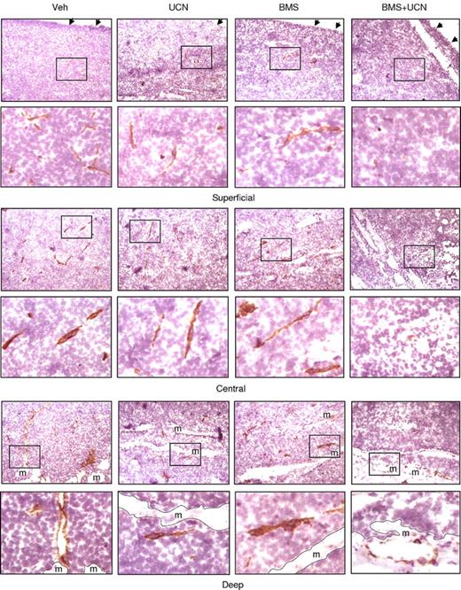 Figure 7. Coadministration of BMS354825 and UCN-01 inhibits angiogenesis in vivo. Following the experiments described in Figure 6, cryosections of the excised tumors were stained by immunohistochemistry using antibodies specifically recognizing murine CD31, an established vascular endothelial marker. Images were captured at 20×/0.50 magnification in the superficial, central, and deep regions within tumors. For each region, areas marked by black squares (top panels) were amplified and shown in the bottom panels. Dashed lines correspond to the borders between tumor and muscle (m). Arrows indicate the dermal facets of tumors.
