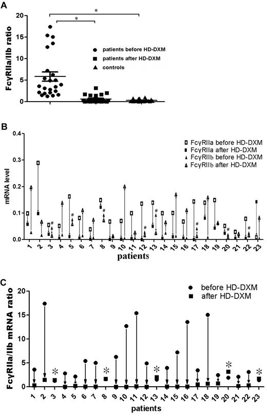 Figure 3. FcγRIIa/IIb mRNA ratio on monocytes from ITP patients and controls, and changes in FcγRIIa/IIb mRNA expression levels in ITP patients before and after treatment. (A) FcγRIIa and FcγRIIb mRNA expression ratio on monocytes from ITP patients before and after treatment and controls was determined by quantitative PCR. The differences among these 3 groups were analyzed using Kruskal-Wallis test and the differences between 2 groups were analyzed using the Nemenyi test. *P < .001. (B) FcγRIIa and FcγRIIb mRNA expression levels on monocytes from ITP patients were measured before and after HD-DXM treatment. #Patients with decreased FcγRIIb mRNA expression after HD-DXM treatment. (C) After administration of HD-DXM, 18 of 23 patients had reduced FcγRIIa/IIb mRNA expression ratios, while the other 5 had similar or higher FcγRIIa/IIb mRNA expression ratios compared with those before treatment. *Patients with increased FcγRIIa/IIb mRNA ratios after HD-DXM treatment.