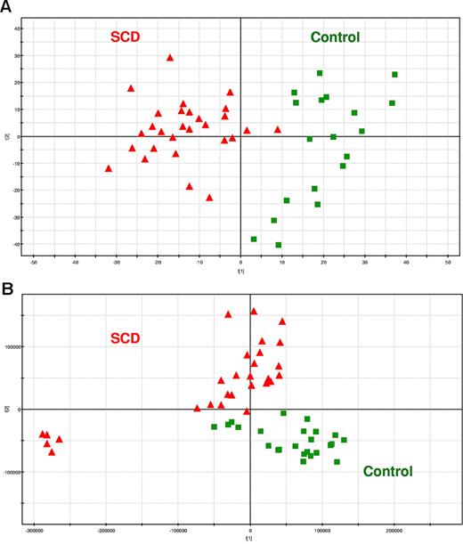 Figure 3. SCD patients and healthy subjects can be individualized on the basis of the metabolic information contained in their RBCs. PCA score plots for RBC extracts obtained from 28 SCD patients and 24 controls. Each point (red triangles and green squares for SCD patients and healthy subjects, respectively) represents an LC/MS metabolic fingerprint. (A) Data acquired in the negative mode of electrospray ionization. The variables contained in the resulting data matrix were mean-centered and scaled to unit variance before PCA. The separation occurs on the first component. (B) Data acquired in the positive mode of ionization. The variables contained in the resulting data matrix were mean-centered and scaled to Pareto variance before PCA. The separation occurs on the second component. (C-D) Impact of the storage of RBC extracts on the metabolic information contained in the LC/MS fingerprints. Blood samples from SCD patients and controls (9 patients, and either 11 or 5 controls, for positive or negative ion mode, respectively) were collected and divided in 2 aliquots, one being immediately extracted and the other frozen,23 before future extraction. (C) PCA scores plot observed with detection in the positive ion mode. (D) Correlation between concentration ratios of SCD patients to controls obtained on fresh and frozen RBC extracts on 34 discriminating metabolites detected in positive ion mode.